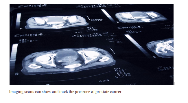 abiraterone acetate tablets, 250 mg film-coated tablets,500 mg film-coated tablets, prostate cancer treatment, Abirataj Taj Pharma