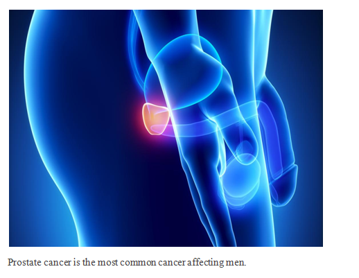 abiraterone acetate tablets, 250 mg film-coated tablets,500 mg film-coated tablets, prostate cancer treatment, Abirataj Taj Pharma